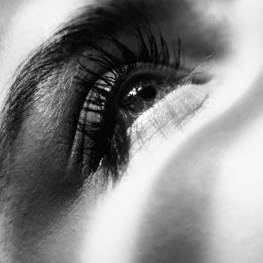 What causes tear troughs and what is tear trough filler?