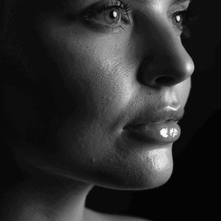 anti-wrinkle Treatments